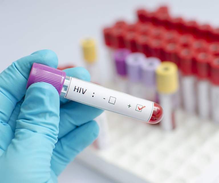 Unidades de Saúde de Nova Friburgo reforçam testagem contra HIV