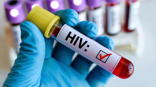 Nova Friburgo soma cerca de 1.200 pessoas vivendo com HIV